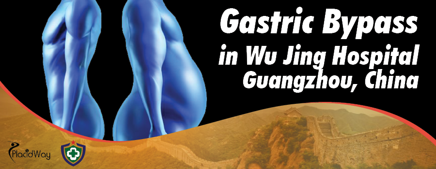 Gastric Bypass in Wu Jing Hospital Guangzhou, China